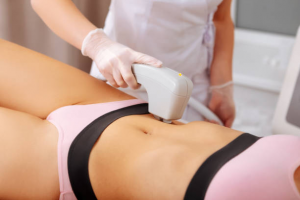The Ultimate Guide to Laser Fat Reduction: Everything You Need to Know
